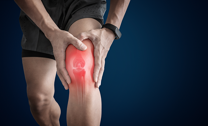Arthritis Treatment