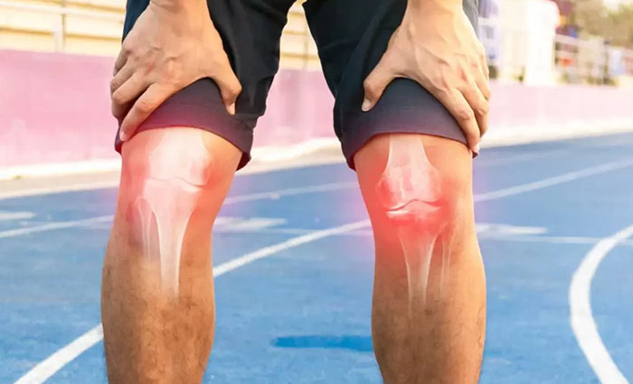 Knee Replacement