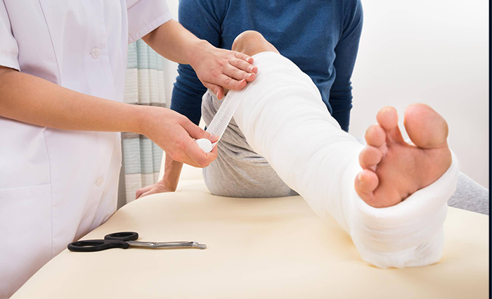 Fracture Treatment