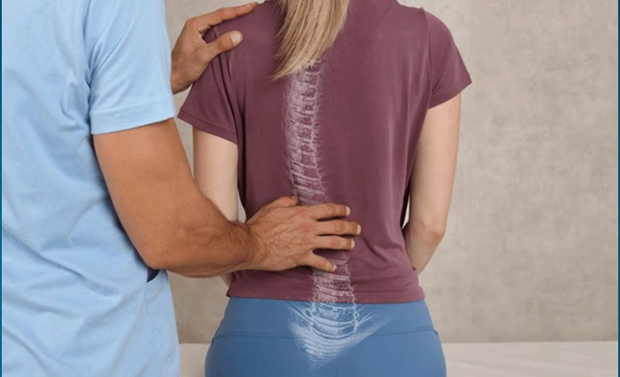 Deformity Correction